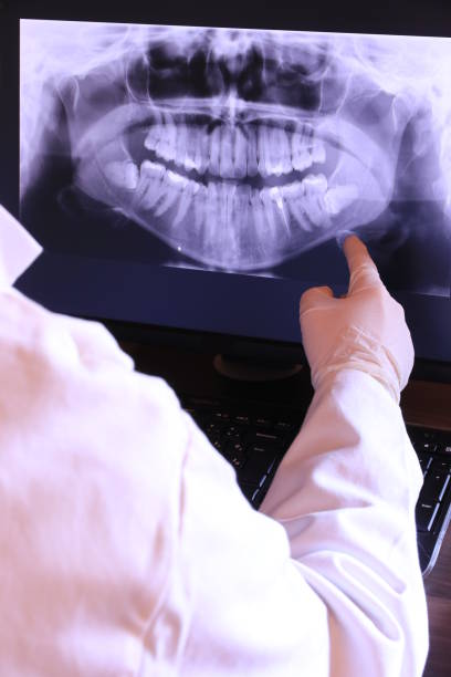 Best Emergency Root Canal Treatment in Kelseyville, CA