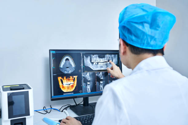 Best Emergency Treatment for Dental Infections or Abscesses in Kelseyville, CA