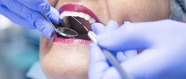 Best Emergency Tooth Extraction in Kelseyville, CA